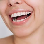 quelle méthode de blanchiment dentaire choisir pour un sourire éclatant