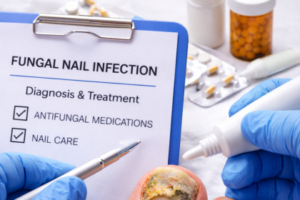 Vivre avec une mycose des ongles : impact au quotidien, patience et solutions sur le long terme